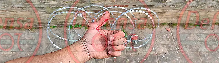 Herida con concertina.